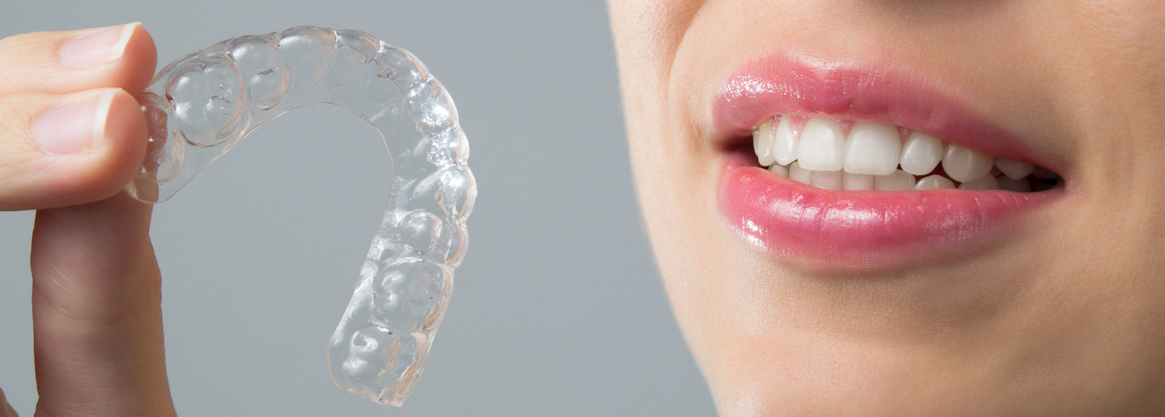 Invisalign